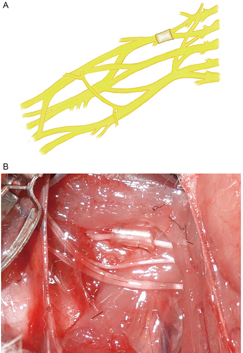 Configuration of superior trunk type model of rat&#x2019;s brachial plexus nerve compression injury.