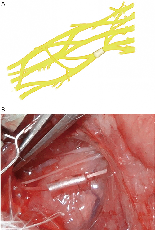 Configuration of inferior trunk type model of rat&#x2019;s brachial plexus nerve compression injury.