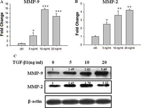 Effect of TGF-&#x03B2;1 on the expression of MMP-2 and MMP-9 in.