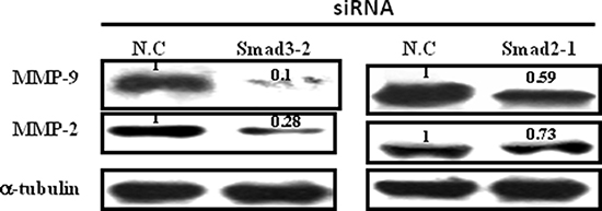 Effect of Smad2 and Smad3 silence on the expression of MMP-9 and MMP-2.