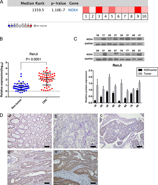 NOX4 expression is up-regulated in CRC.