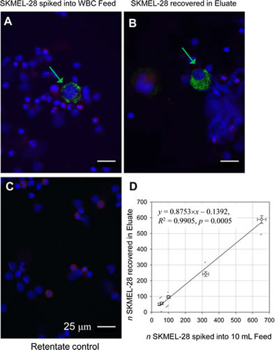 Melan-A positive and CD45 negative cells correlate with the SKMEL-28 melanoma cells added to the leukocyte preparation.