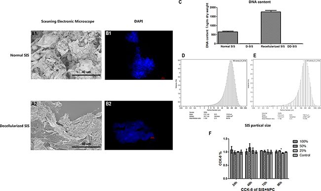 Effects of first time decellularization and SIS particle analysis.