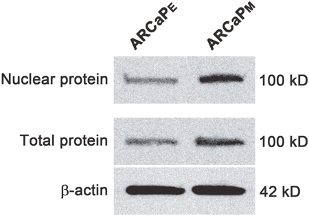 Western blot of MCM3 in ARCaPE and ARCaPM cells.