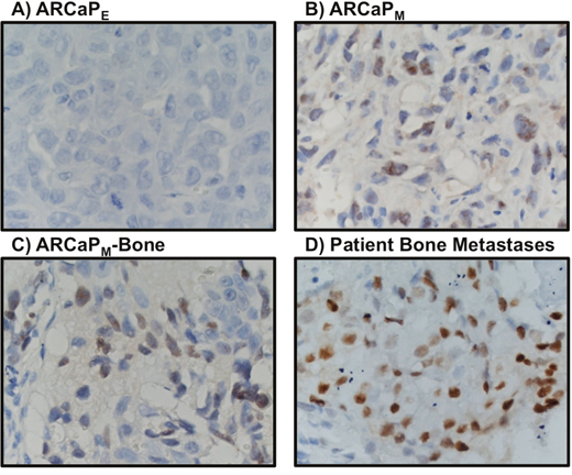 MCM3 expression profiling in ARCaPE cells