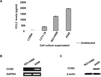 Expression of CCL2 and CCR2 in human NSCLC cell lines.