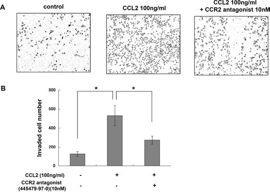 CCR2 antagonist inhibited CCL2-mediated A549 cell invasion in vitro.