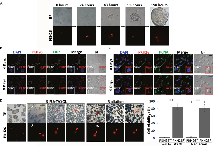 Identification of quiescent CSC-like cells in spheres.