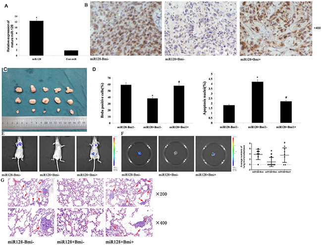 miR-128 decreases tumor growth and metastasis by Bmi-1 in nude mice.