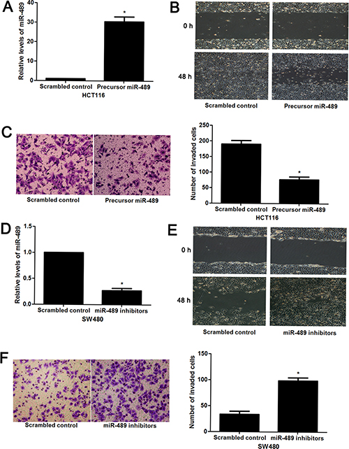 miR-489 regulates migration and invasion of CRC cells.