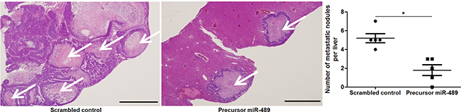 miR-489 overexpression inhibits liver metastasis of CRC in nude mice.