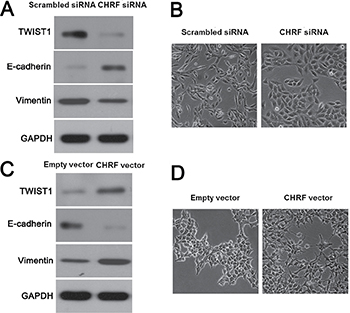 LncRNA CHRF induced miR-489 loss promotes EMT process of CRC cells.