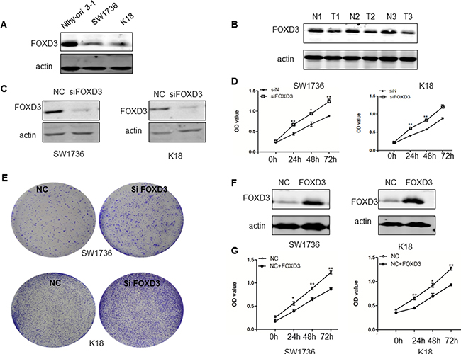 FOXD3 promotes anaplastic thyroid cancer cell growth and proliferation.