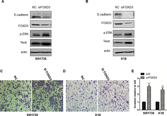 FOXD3 silencing increased invasiveness and EMT attributes of ATC cell lines.