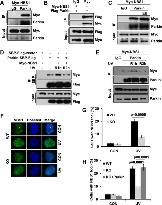 Parkin interacts with NBS1 and regulates its redistribution after exposure to UV radiation.