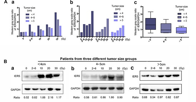 The association between IER5 expression and tumor size.