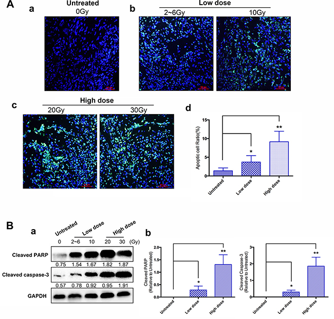 Effects of IER5 upon radiation-induced cell apoptosis in cervical cancer tissues.