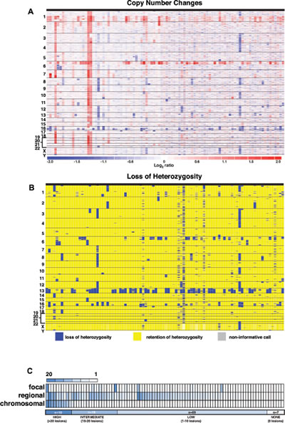 Copy Number Changes and LOH in Human Retinoblastoma.