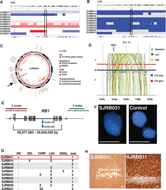 Whole Genome Sequence Analysis of Retinoblastoma.