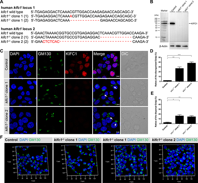 Kifc1 knockout also results in the disorganization and dispersal of the Golgi apparatus.