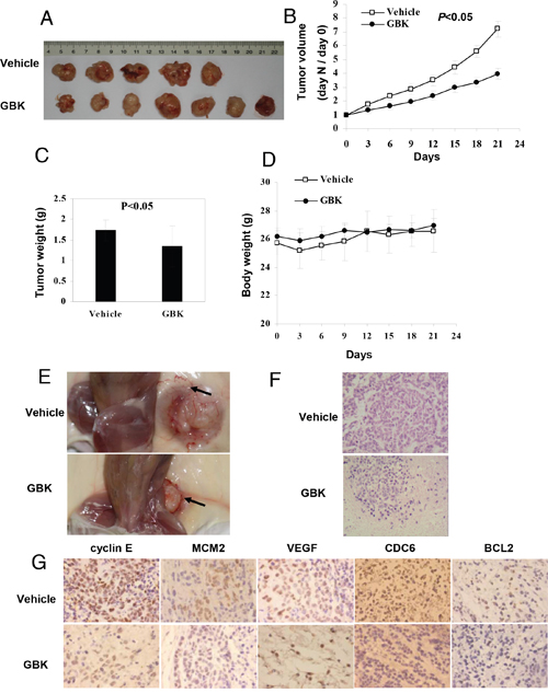 In vivo antitumor effects of GBK on NOD/SCID mice bearing MCF-7 cells.