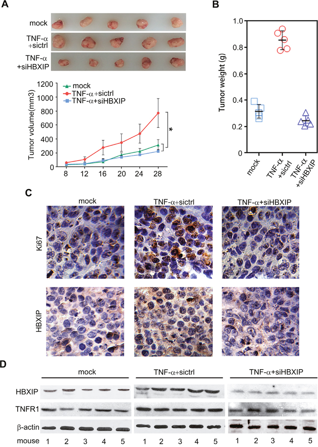 TNF-&#x03B1; promotes the growth of breast cancer through HBXIP in vivo.