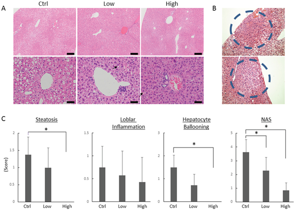 Effects of tofogliflozin on the development of pre-neoplastic lesions and histopathology in the liver of the experimental mice.