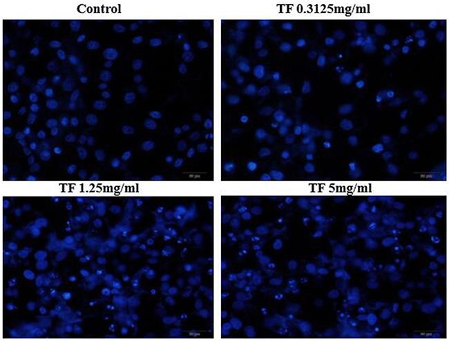 Effect of TF on morphology of HepG2 cells by Hoechst33258 staining (200X).
