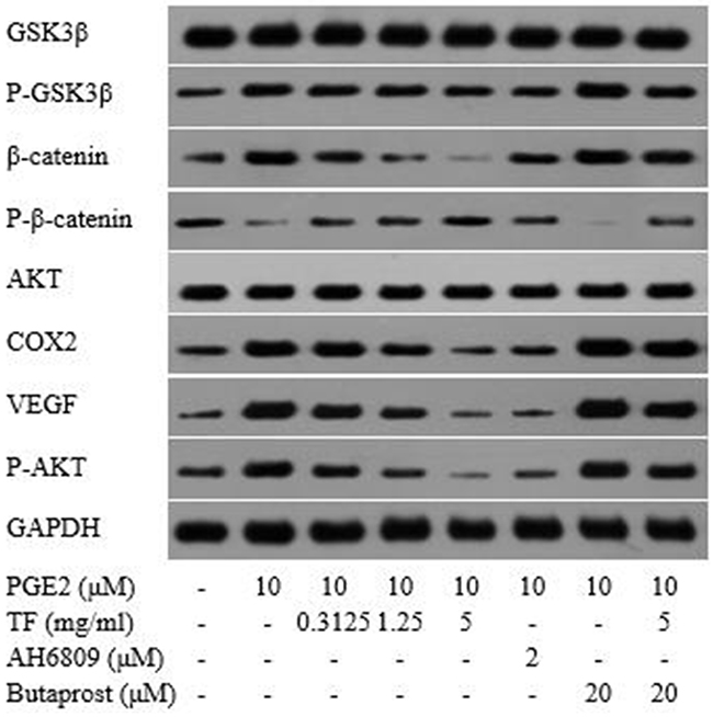 Detection of protein expressions related to COX-2-Wnt/&#x03B2;-catenin pathway by Western blot.
