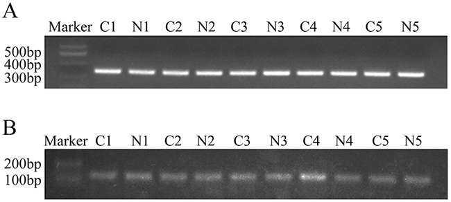 PCR analysis of the C8orf4 gene locus and the CpG island of C8orf4 after bisulfite conversion.