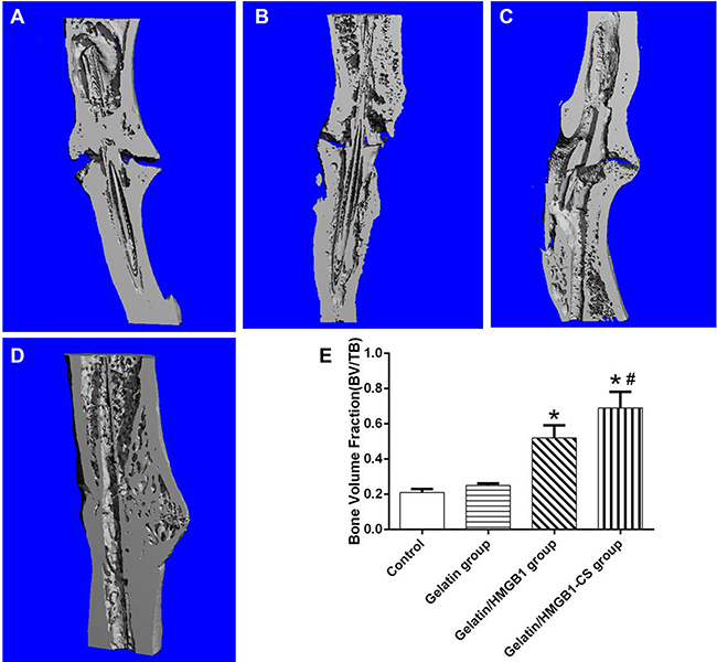 Longitudinal sections of osteotomized rat tibia 8 weeks postoperatively, as seen on microcomputed tomography (micro-CT) images.