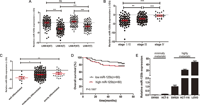 High expression level of miR125b was related to metastasis, advanced stages, poor differentiation and poor survival of CRC.