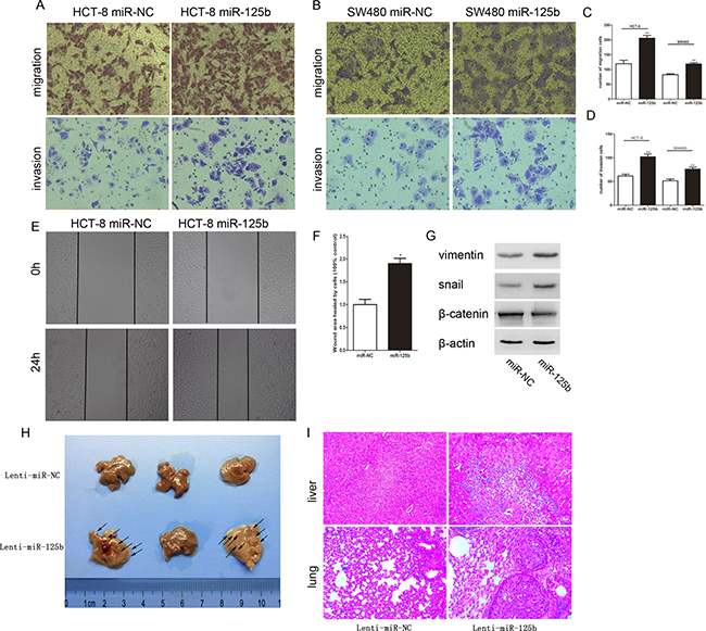 MiR-125b promoted the migration and invasion of CRC cells in vitro and in vivo.