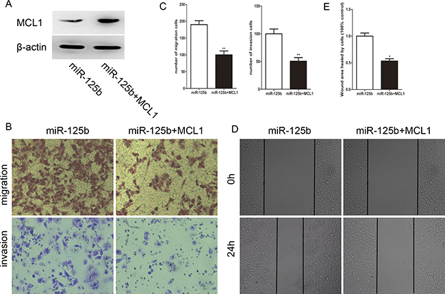 Reexpression of MCL1 reverses the effect of migration and invasion induced by miR-125b in HCT-8.