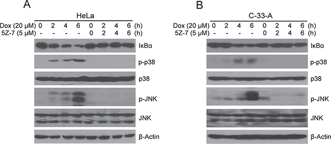 5Z-7-oxozeaenol inhibits Dox-induced NF-&#x03BA;B, JNK and p38 activation.