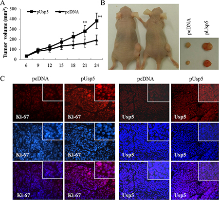 Usp5 overexpression promoted tumorigenicity in vivo.