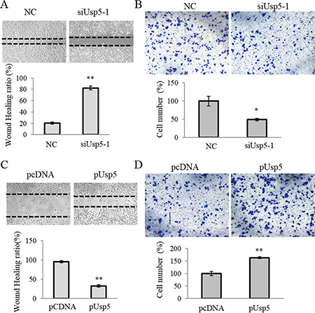 Usp5 stimulated migration of HCC cells.