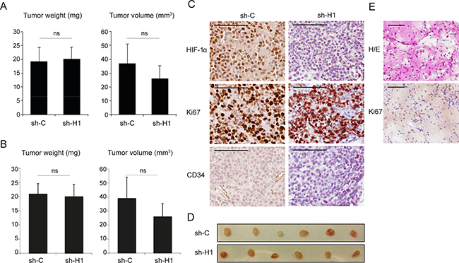 Repressed HIF1A expression does not significantly affect tumor growth in SCLC cell xenografts.