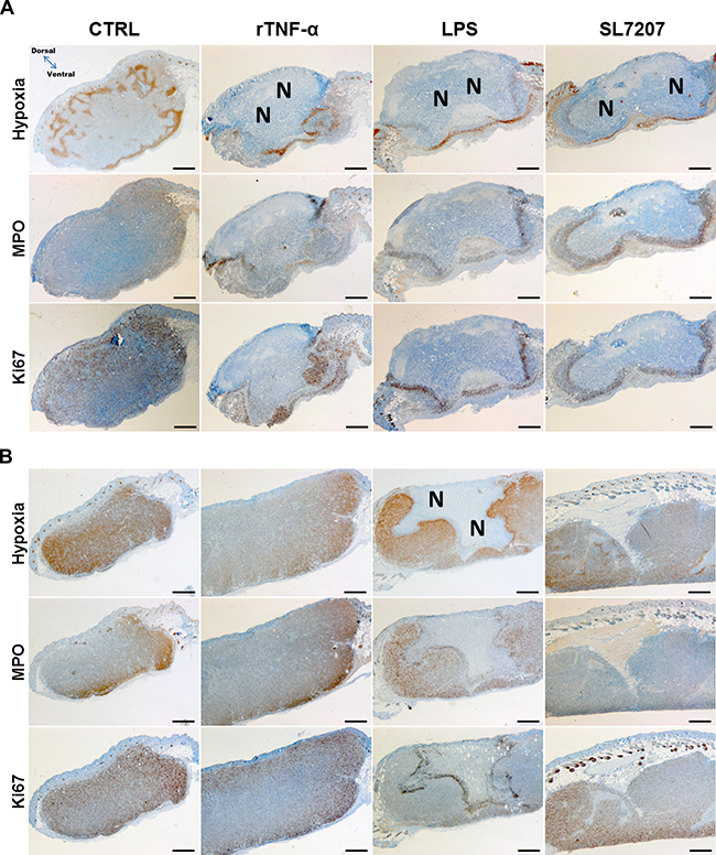 Prognostic characteristics of the CT26 tumor are shared among different immunogenic treatments, and less pronounced in RenCa.