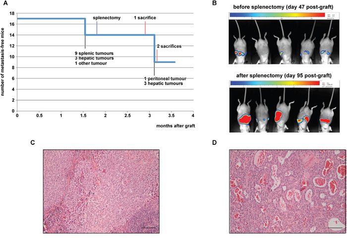 Analysis of intrasplenic xenografts.