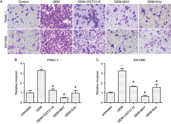HPA1 inhibitor attenuates gemcitabine-induced invasiveness of PC cells in vitro.
