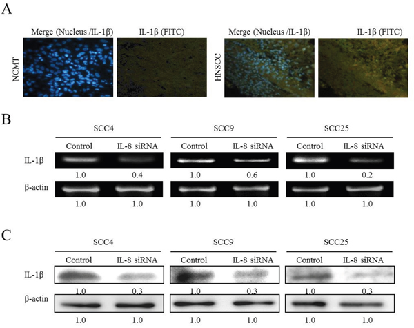 IL-8 siRNA reduces IL-1&#x03B2; expression in HNSCC cells.
