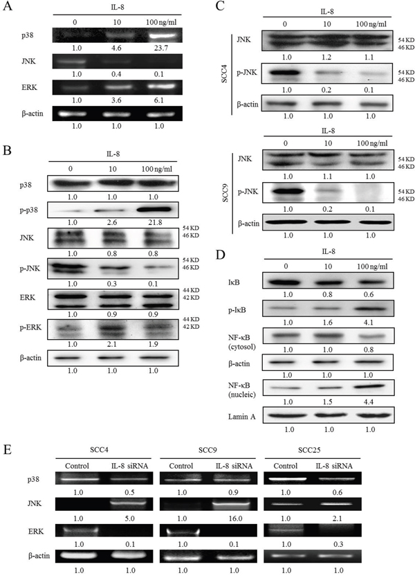 Activation of p38 MAPK/ERK-NF-&#x03BA;B pathway and reduction of JNK expressions in IL-8-stimulated HNSCC cells.