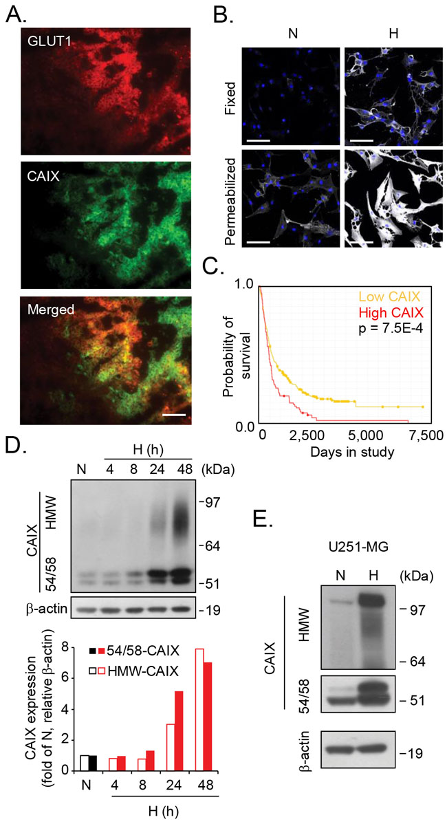 Identification of a heterogeneous, high molecular weight variant of CAIX.