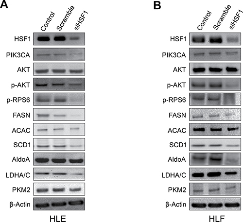 Suppression of HSF1 expression by specific siRNA induces downregulation of the PI3K/AKT/mTOR pathway.