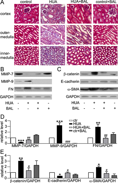 Effect of baicalein on fibrosis and EMT related proteins in mice.