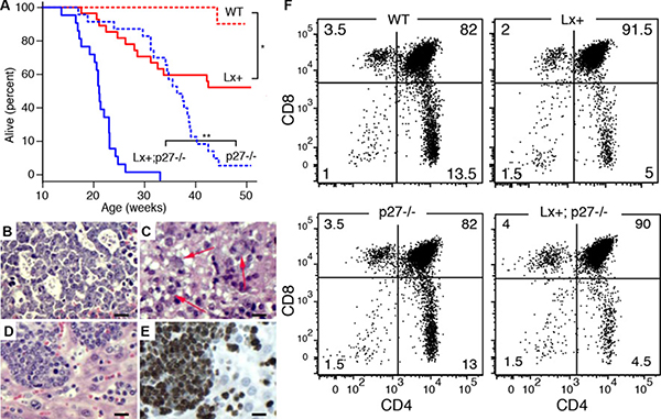Cooperation with p27Kip1 loss in miR-106a~363 induced lymphomas.