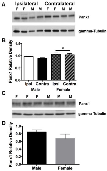 Panx1 protein in cortex is overall higher in females compared to males subjected to permanent MCA occlusion.