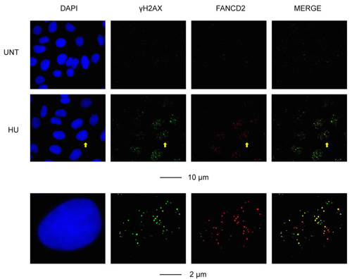 Representative images of the cellular response to RS (induced by a low dose of hydroxyurea; HU) in U2OS cells, as determined by IF staining for &#x3b3;H2AX and FANCD2.