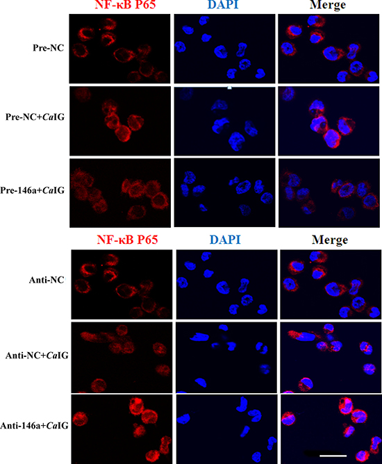 MiR-146a suppresses the CaIG -induced translocation of NF-&#x03BA;B P65 in THP-1 cells.